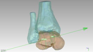 Artificial Ankle Model 2